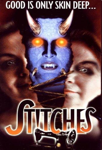 Stitches image