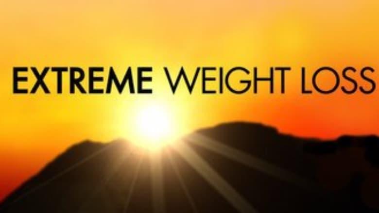 Extreme Weight Loss image