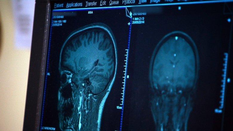 Mind Games image
