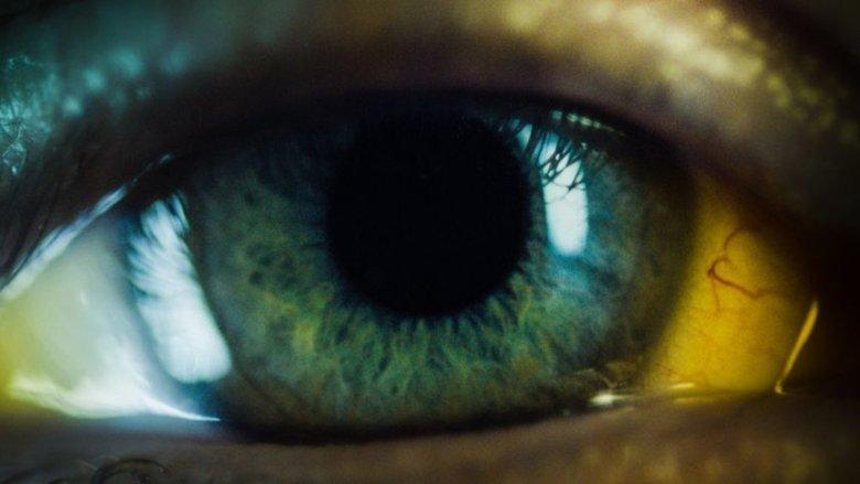 Nocebo image