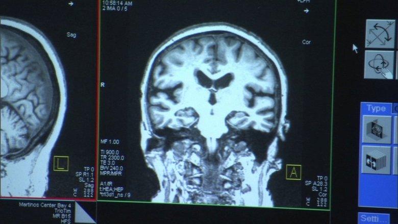 The Alzheimer's Project image