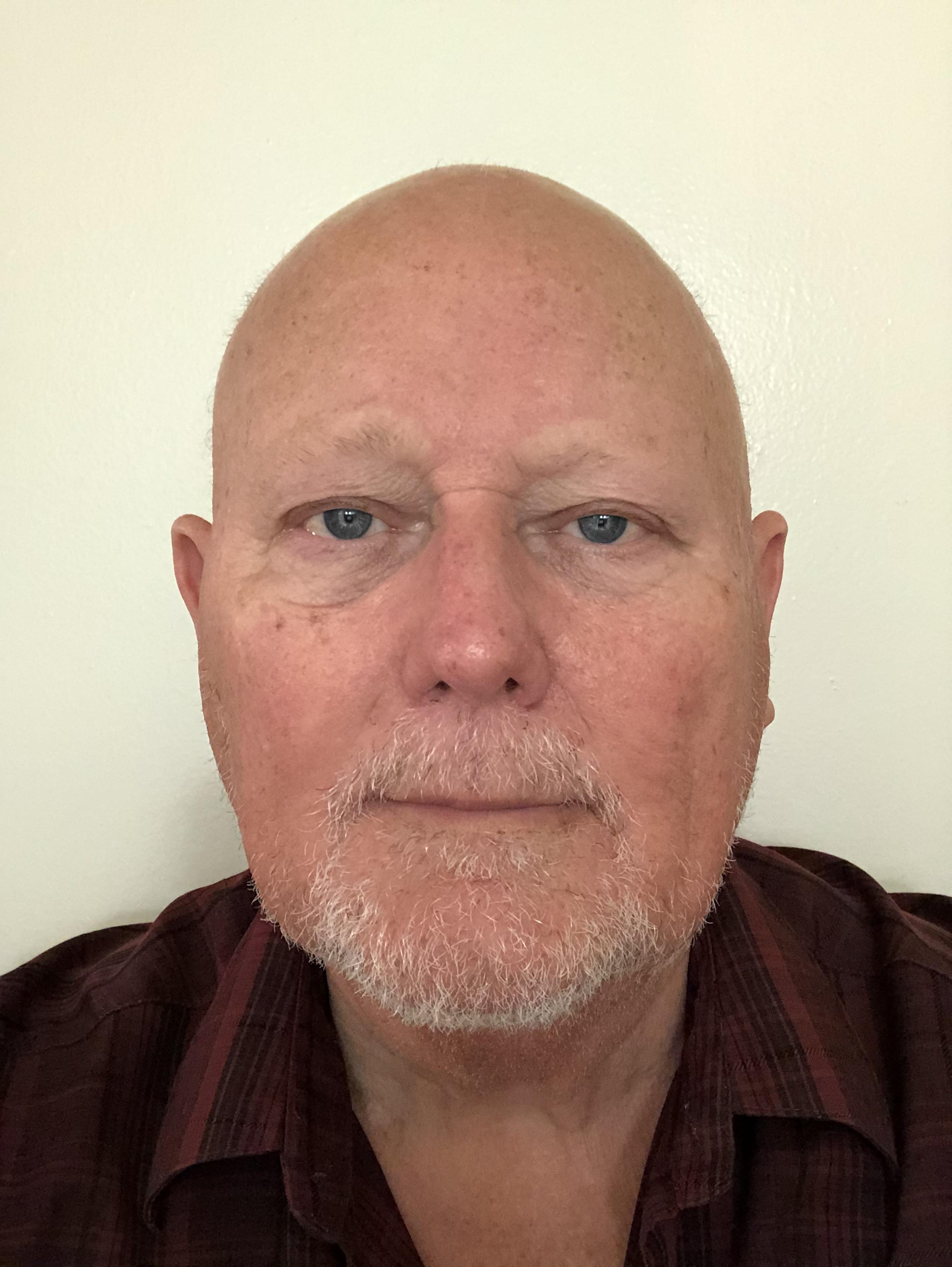 Gary Teague image