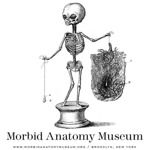 The Morbid Anatomy Transmission image